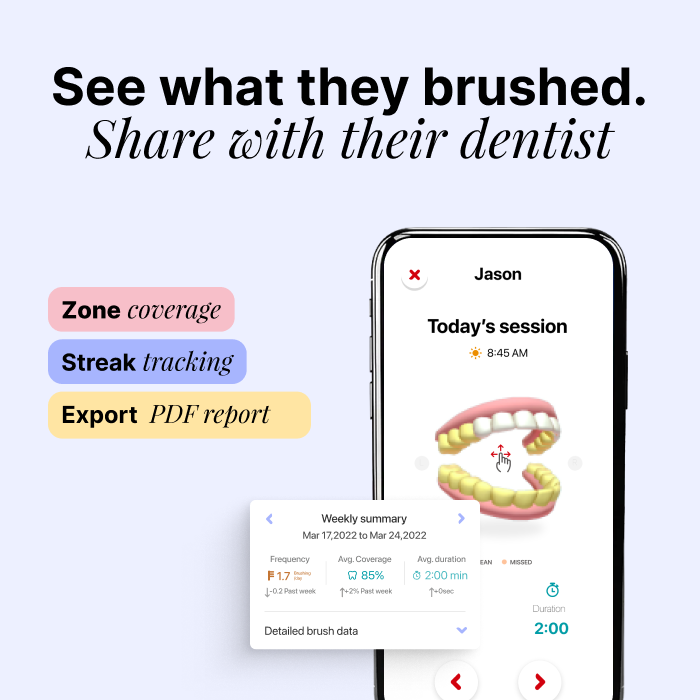Kolibree Smart Toothbrush System